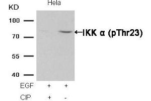 Western blot analysis of extracts from Hela cells, treated with EGF or calf intestinal phosphatase (CIP), using IKK α (Phospho-Thr23) Antibody.