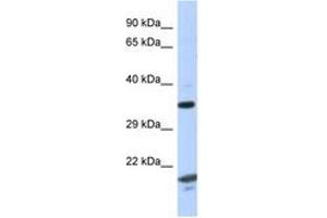 Image no. 1 for anti-rho GTPase Activating Protein 2 (ARHGAP2) (AA 229-278) antibody (ABIN6747618) (CHN1 anticorps  (AA 229-278))