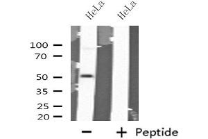 Western blot analysis of extracts from HeLa cells using GABRA6 antibody. (GABRA6 anticorps  (N-Term))