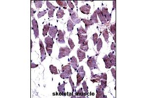 TrkA-p Antibody ((ABIN652381 and ABIN2841827))immunohistochemistry analysis in formalin fixed and paraffin embedded human skeletal muscle followed by peroxidase conjugation of the secondary antibody and DAB staining. (TrkA-pY791 (AA 769-796) anticorps)