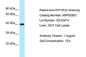 Western Blotting (WB) image for anti-Protein Phosphatase 1, Regulatory Subunit 3C (PPP1R3C) (N-Term) antibody (ABIN2789287) (PPP1R3C anticorps  (N-Term))