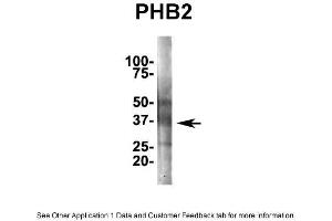 IP Suggested AntiPhb2 Antibody Positive Control: NT2 CELL/BRAIN TISSUE