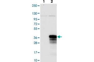 Western blot analysis of Lane 1: Negative control (vector only transfected HEK293T lysate). (NOPCHAP1 anticorps)