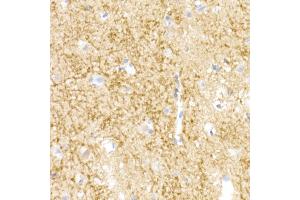Immunohistochemistry of paraffin-embedded human brain using NgR3 Rabbit mAb (ABIN7269932) at dilution of 1:50 (40x lens). (RTN4RL1 anticorps)