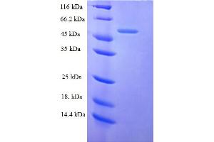 SDS-PAGE (SDS) image for Transmembrane Protein 25 (TMEM25) (AA 27-322), (Isoform 2) protein (His-SUMO Tag) (ABIN5710510)
