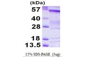 SDS-PAGE (SDS) image for BAI1-Associated Protein 2 (BAIAP2) (AA 1-522) protein (His tag) (ABIN667653)