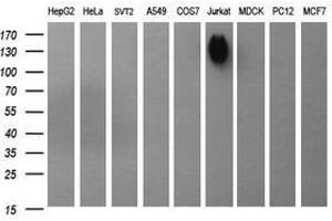 Image no. 1 for anti-Protein tyrosine Phosphatase, Receptor Type, C (PTPRC) antibody (ABIN1497331) (CD45 anticorps)