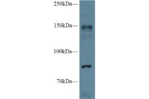 Western blot analysis of Mouse Cerebrum lysate, using Mouse NOS2 Antibody (1 µg/ml) and HRP-conjugated Goat Anti-Rabbit antibody ( (NOS2 anticorps  (AA 43-213))