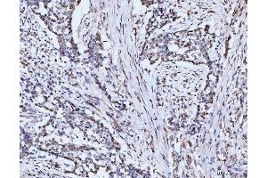 IHC analysis of 53BP1/TP53BP1 using anti-53BP1/TP53BP1 antibody (ABIN7599869). (TP53BP1 anticorps  (AA 1239-1972))