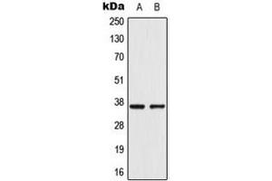 Western blot analysis of AKR1CL2 expression in VEC (A), A549 (B) whole cell lysates.