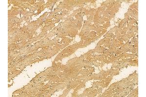 C2CD2 Mouse Monoclonal Antibody at 1/100 staining rat heart tissue by IHC-P. (C2CD2 anticorps)