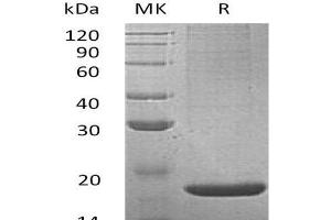 Western Blotting (WB) image for Regenerating Islet-Derived 2 (REG2) protein (His tag) (ABIN7320608)