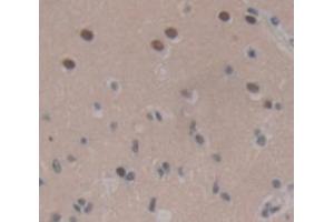 Figure. (LIM Domain Binding 1 Protein anticorps  (AA 112-411))