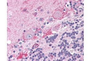 Anti-CNR1 / CB1 antibody IHC of human brain, cerebellum.