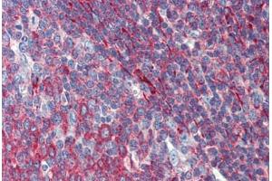 Tonsil, Human: Formalin-Fixed, Paraffin-Embedded (FFPE) (PHACTR1 anticorps  (AA 468-517))