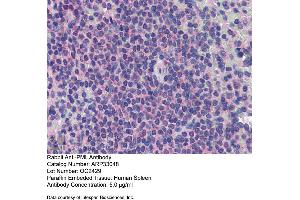 Immunohistochemistry (IHC) image for anti-Promyelocytic Leukemia (PML) (C-Term) antibody (ABIN2777721) (PML anticorps  (C-Term))