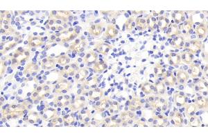 Detection of TNIP2 in Mouse Kidney Tissue using Polyclonal Antibody to Tumor Necrosis Factor Alpha Induced Protein 3 Interacting Protein 2 (TNIP2)