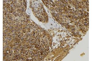 ABIN6273393 at 1/100 staining Human pancreas tissue by IHC-P.