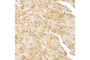 Immunohistochemistry of paraffin-embedded mouse heart using ACTN1 antibody at dilution of 1:100 (400x lens).