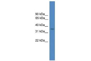 WB Suggested Anti-FLJ36070 Antibody Titration: 0. (FLJ36070 (Middle Region) anticorps)