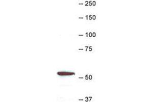 Western blot of CORO1A in HL-60 Cell extract stained with RPCA-Cor1a CORO1A polyclonal antibody  at dilution of 1 : 10000. (Coronin 1a anticorps)