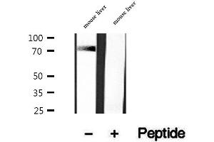 Western blot analysis of extracts of mouse liver tissue, using DNAJC10 antibody. (DNAJC10 anticorps  (C-Term))