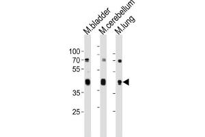 Western Blotting (WB) image for anti-Cholecystokinin A Receptor (CCKAR) antibody (ABIN3004717) (CCKAR anticorps)