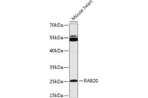 Western blot analysis of extracts of Mouse heart, using R antibody (ABIN7269800) at 1:1000 dilution. (RAB20 anticorps  (AA 80-190))