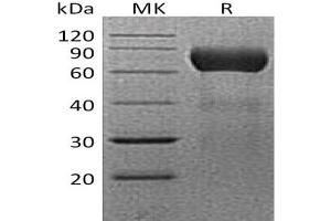 Western Blotting (WB) image for Ectonucleoside Triphosphate diphosphohydrolase 2 (ENTPD2) protein (His tag) (ABIN7320836) (ENTPD2 Protein (His tag))