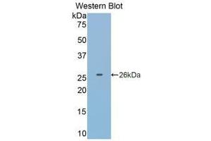 Detection of Recombinant GSTp, Human using Monoclonal Antibody to Glutathione S Transferase Pi (GSTp) (GSTP1 anticorps  (AA 1-210))