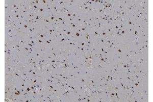 ABIN6276871 at 1/100 staining Human heart tissue by IHC-P. (Cyclin D2 anticorps  (C-Term))