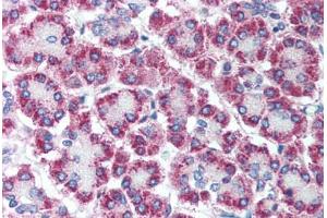 Human Pancreas (formalin-fixed, paraffin-embedded) stained with CPA1 antibody ABIN214091 at 5 ug/ml followed by biotinylated goat anti-rabbit IgG secondary antibody ABIN481713, alkaline phosphatase-streptavidin and chromogen.