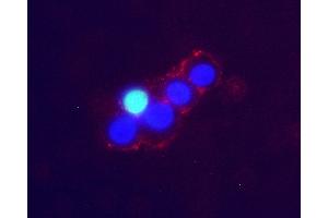 Expression of Noradrenaline transporter (NET) in live intact rat PC12 cellsCell surface detection of Noradrenaline transporter (NET) in live intact rat pheochromocytoma PC12 cells.