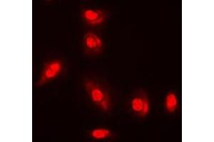 Immunofluorescent analysis of AKT (pY315) staining in A549 cells. (AKT1 anticorps  (pTyr315))