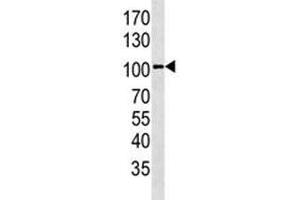 GPR49 antibody western blot analysis in HepG2 lysate