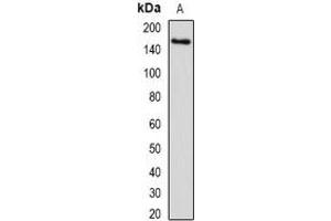 Western blot analysis of SETD5 expression in human liver (A) whole cell lysates.