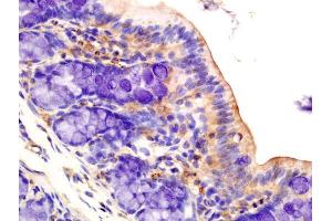 Formalin-fixed and paraffin embedded rat colon tissue labeled with Anti-AMPK alpha-1 Polyclonal Antibody, Unconjugated (ABIN2170161) at 1:200 followed by conjugation to the secondary antibody and DAB staining