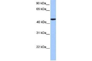 Human Lung; WB Suggested Anti-REXO4 Antibody Titration: 0. (REXO4 anticorps  (Middle Region))