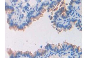 Detection of F5 in Mouse Lung Tissue using Polyclonal Antibody to Coagulation Factor V (F5)