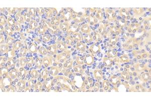 Detection of CHRDL1 in Mouse Kidney Tissue using Polyclonal Antibody to Chordin Like Protein 1 (CHRDL1) (CHRDL1 anticorps  (AA 272-447))