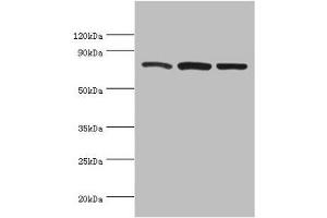 Western blot All lanes: Calpain-1 catalytic subunit antibody at 2 μg/mL Lane 1: A431 whole cell lysate Lane 2: Hela whole cell lysate Lane 3: Jurkat whole cell lysate Secondary Goat polyclonal to rabbit IgG at 1/10000 dilution Predicted band size: 82 kDa Observed band size: 82 kDa (CAPNL1 anticorps  (Catalytic Subunit))