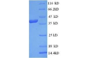SDS-PAGE (SDS) image for Eukaryotic Translation Initiation Factor 4 Gamma, 1 (EIF4G1) (AA 1250-1599), (partial) protein (His tag) (ABIN5713424)
