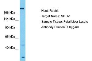 Host: Rabbit Target Name: SPTA1 Sample Tissue: Human Fetal Liver Antibody Dilution: 1ug/ml (SPTA1 anticorps  (N-Term))