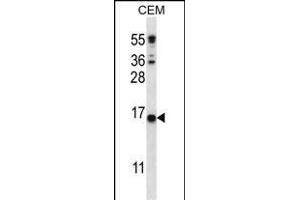 C Antibody (C-term) (ABIN656407 and ABIN2845701) western blot analysis in CEM cell line lysates (35 μg/lane). (CJ057 anticorps  (C-Term))