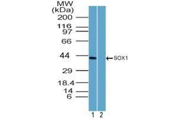 SOX1 anticorps  (AA 100-150)