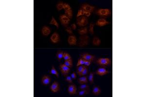 Immunofluorescence analysis of A-549 cells using CYFIP1 Rabbit mAb (ABIN7266665) at dilution of 1:50 (40x lens). (CYFIP1 anticorps)