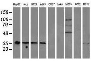 Image no. 11 for anti-Nonhomologous End-Joining Factor 1 (NHEJ1) antibody (ABIN1499729) (NHEJ1 anticorps)