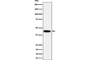 Western blot analysis of GALT expression in K562 cell lysate.
