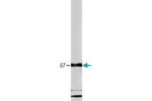 Western blot analysis using ACVR1 polyclonal antibody on ACVR1 fusion protein.