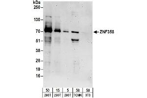 anti-Zinc Finger Protein 358 (ZNF358) (AA 518-568) antibody